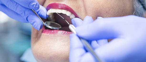 Best Emergency Root Canal Treatment in Buffalo, NY