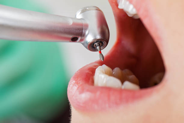 Best Emergency Dental Services for Seniors in Buffalo, NY
